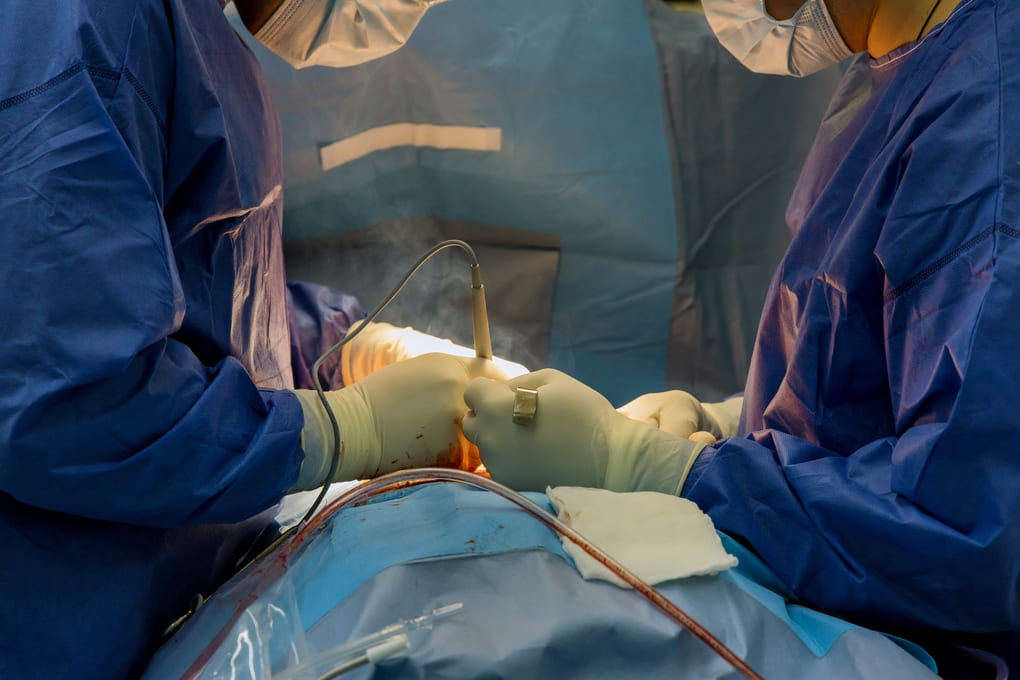 El impacto de Aesculap AEOS en la neurocirugía moderna de Panamá